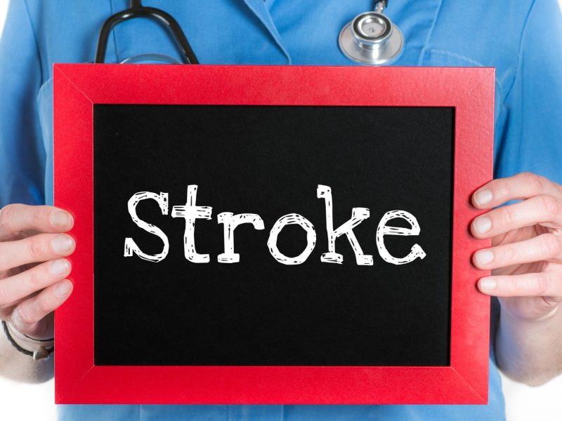 Understanding Strokes