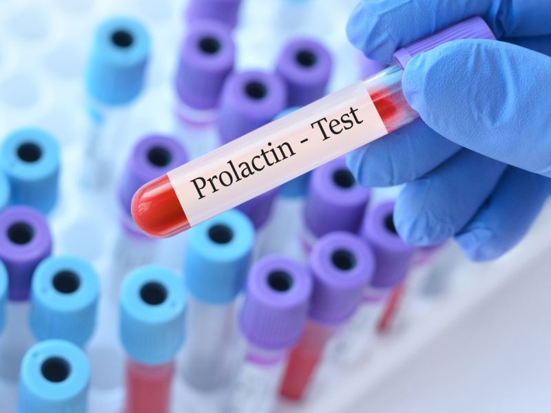 Prolactin Hormone