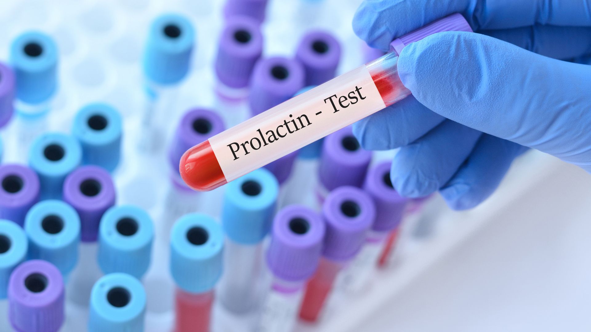Prolactin Hormone
